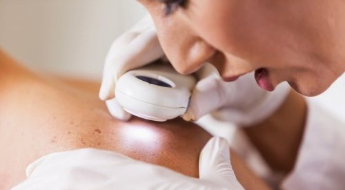 Sweden sees skin cancer decline in under-50s for 1st time: study